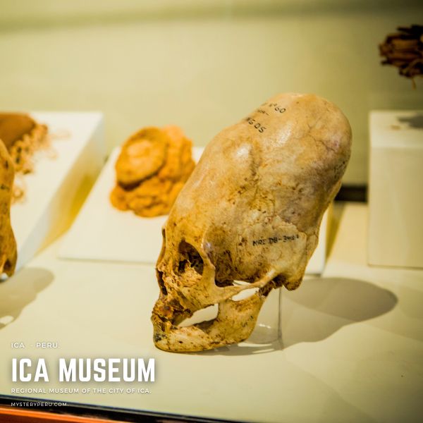 Ica Museum - Deformed Skull