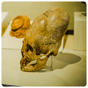 Deformed Skull at Ica Museum